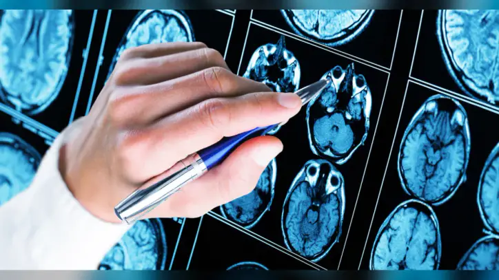 Alzheimer tedavisinde yeni dönem! Antikor tedavisi evde uygulanabilecek