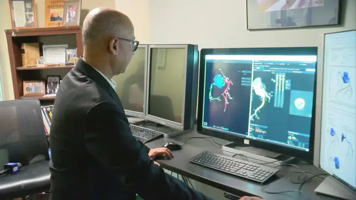 Batavia hospital debuts AI-powered technology meant to improve heart care