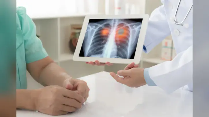 Advancing Access to Lung Cancer Care Through Artificial Intelligence Innovation