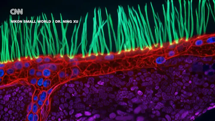 Contest-Winning Microscope Video Thrown Out for Using Generative AI