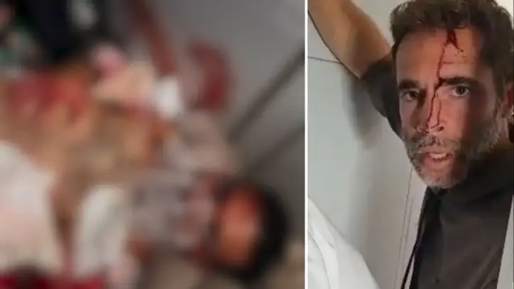 Graphic video shows blood-drenched pilot clinging to life after ‘attempted terror attack’