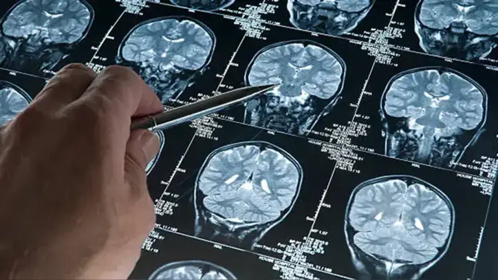 Her 3 saniyede bir kişi demans oluyor Bakanlıktan Alzheimer uyarısı