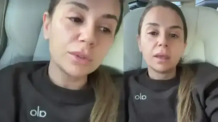 Merdivenden Düşmüştü! Merve Özbey Sağlık Durumunu Açıkladı - Magazin Haberleri