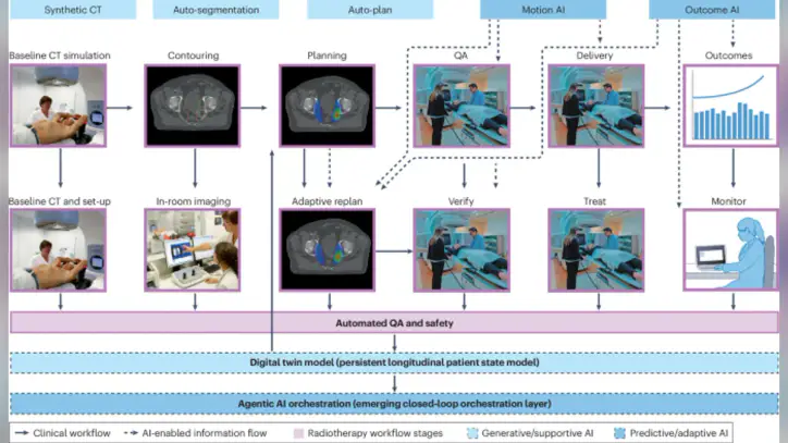 Optimizing the delivery of radiotherapy with artificial intelligence - Nature Reviews Clinical Oncology