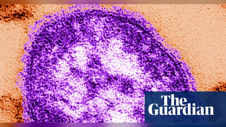 Six-week-old child in Pennsylvania dies from measles, coroner says