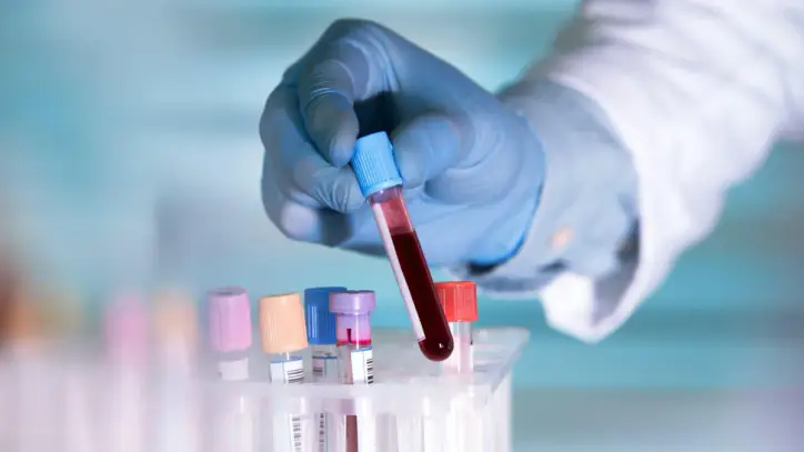 Study Suggests AI-Generated Drug Could Slow Aging