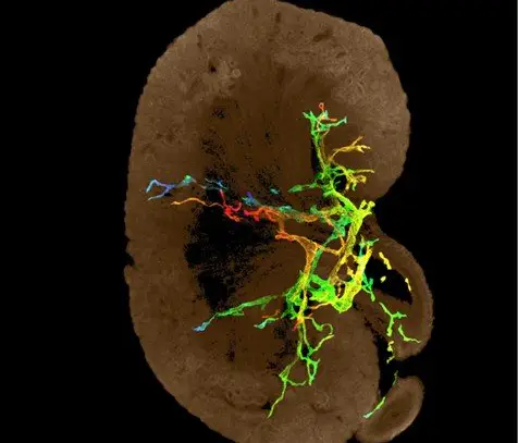 3D imaging of lymphatic vessels