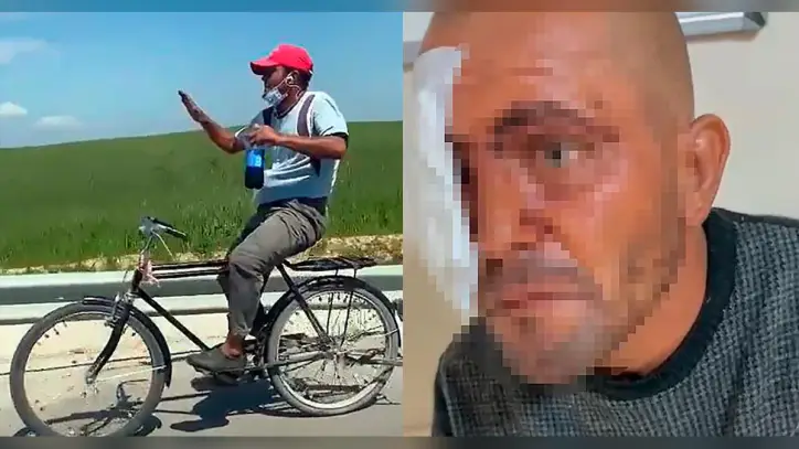 Zihinsel engelli sosyal medya fenomeni darbedildi - Sözcü Gazetesi